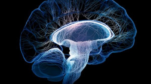 Brain xray image