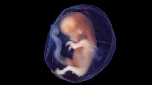 Um feto de bebê.