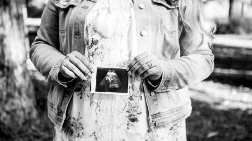 Uma mulher segurando a imagem de ultrassom de um bebê na frente de sua barriga.