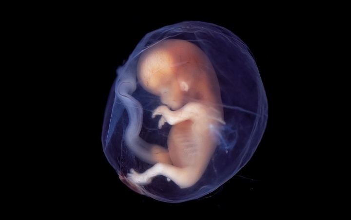 Um feto de bebê.