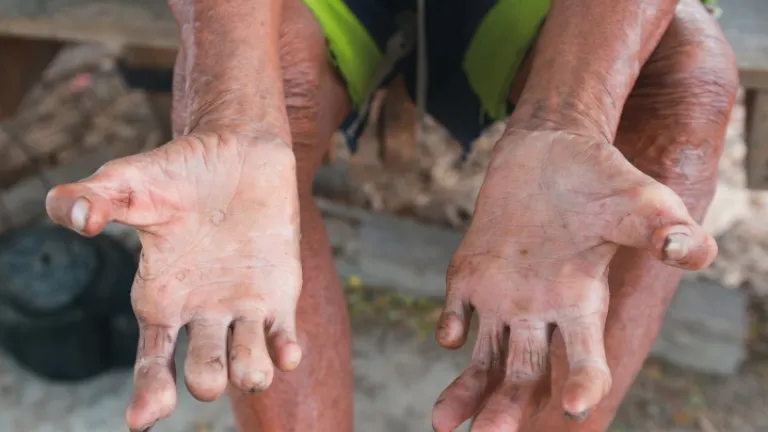 Braços e mãos dum homem.